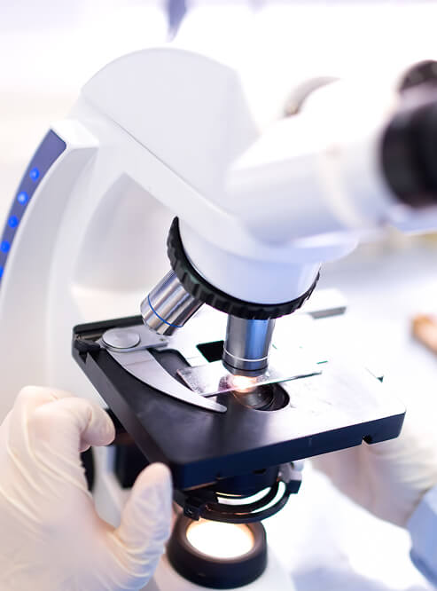 микроскопическое и микологическое исследование