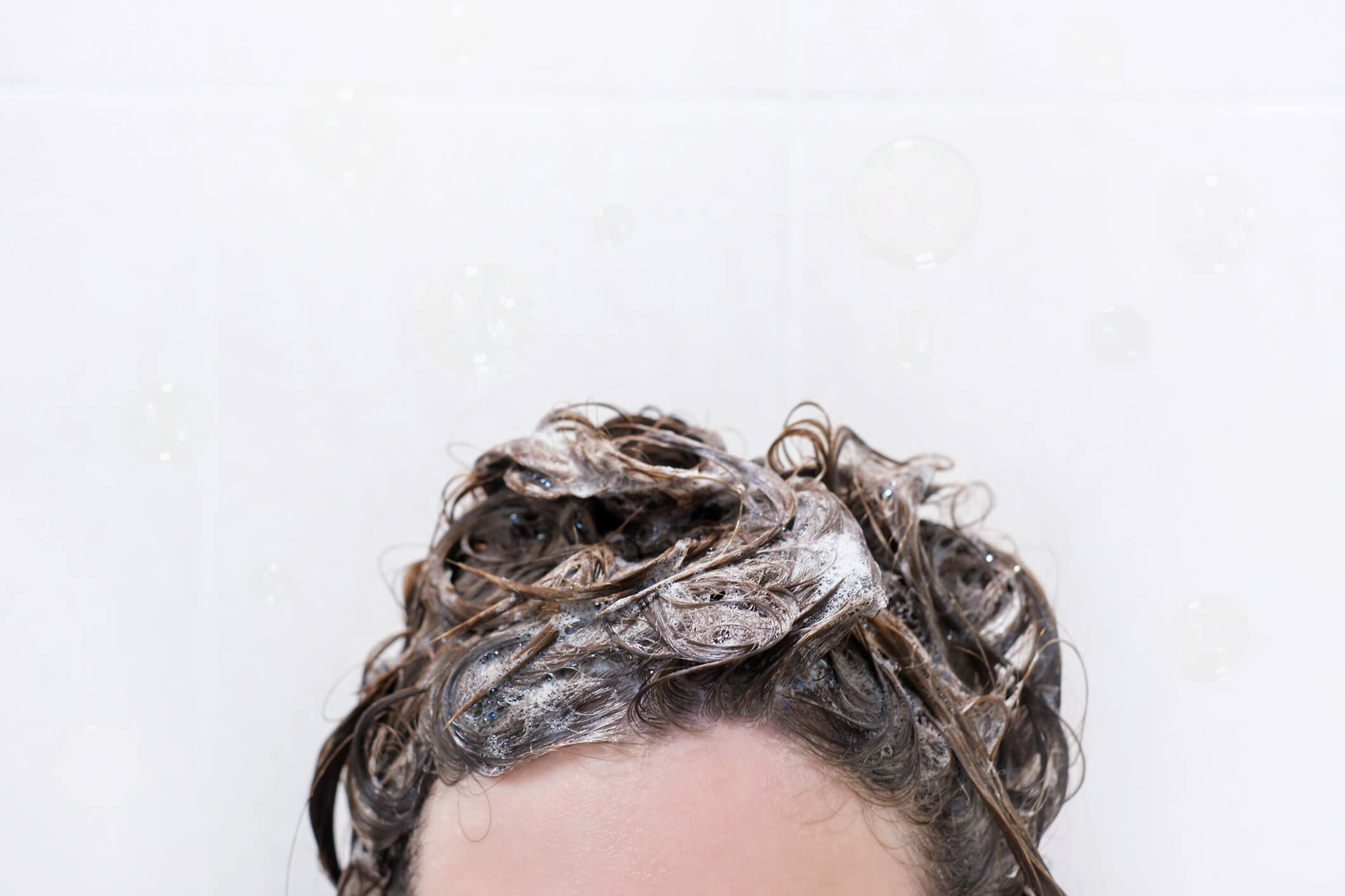 наружные средства от перхоти